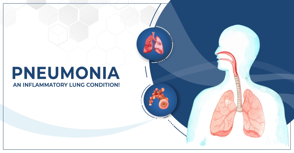 Complications of Pneumonia