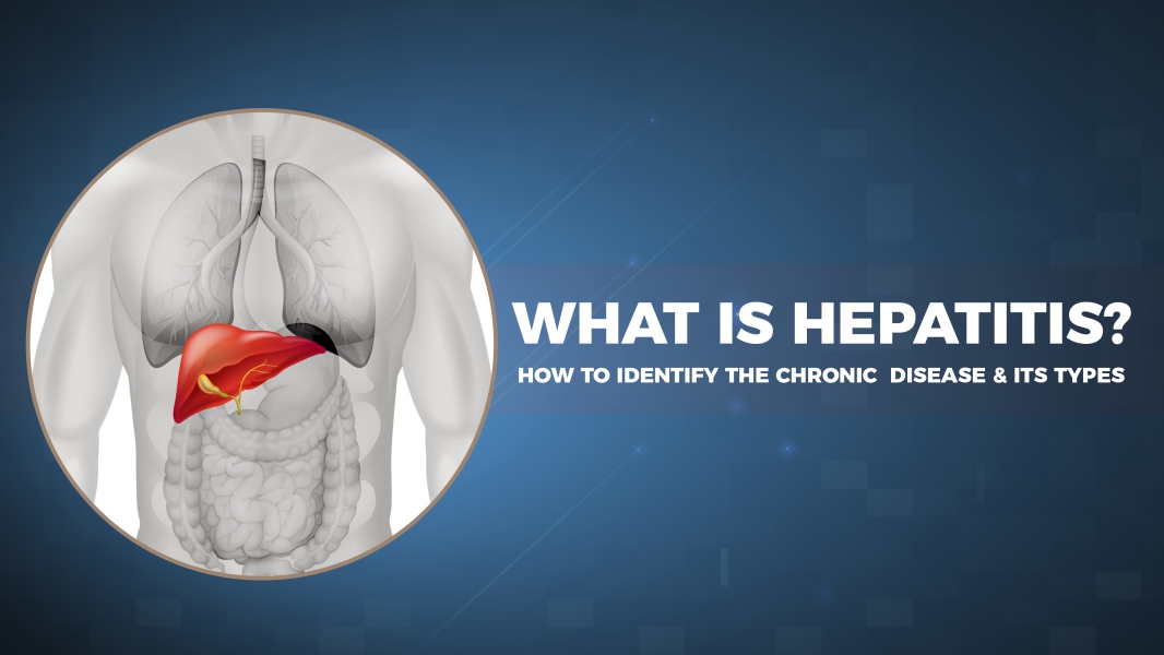 Overview of Hepatitis and its Types A, B, C, D & E 