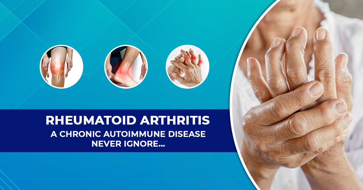 What are the Causes of Rheumatoid Arthritis